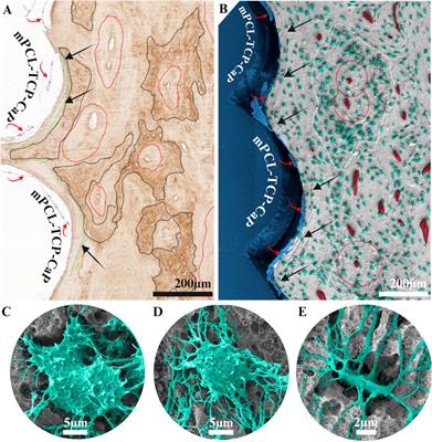 Histodynamics of calcium phosphate coating on the osseointegration of medical-grade polycaprolactone β-tricalcium phosphate scaffolds